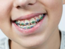 jung teenage boy wearing braces happily