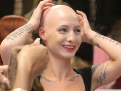What You May Not Know About Alopecia