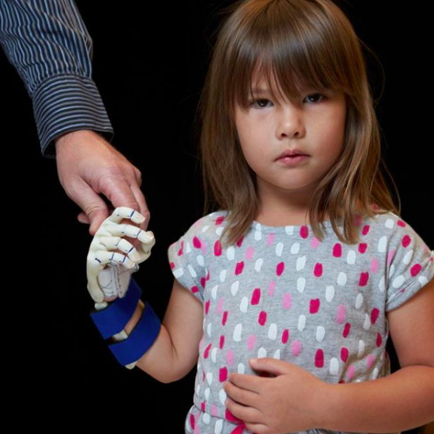 Girl with 3D-Printed Hand Dreams of Throwing the First Pitch at every